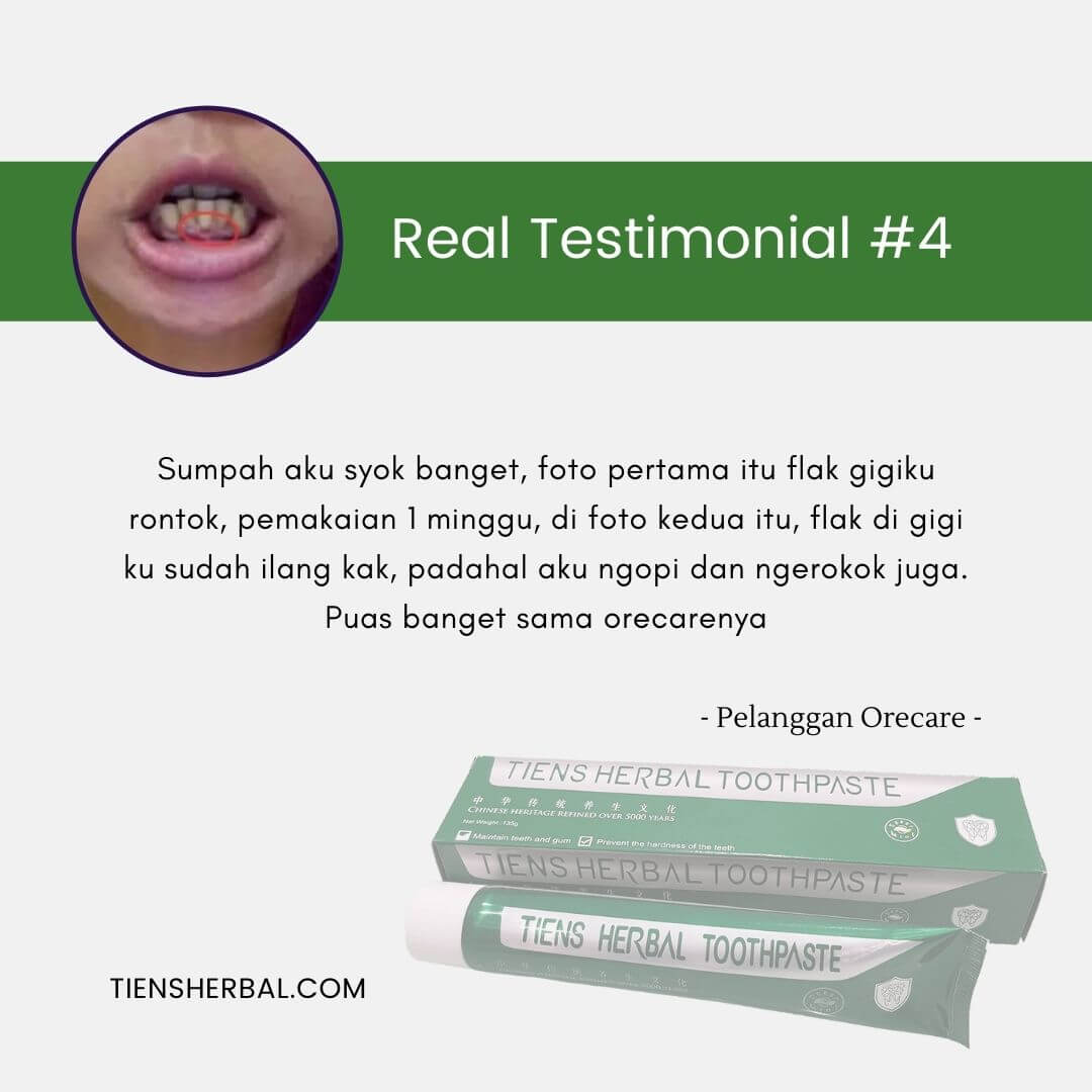 Orecare-tiens-pemutih-gigi-perontok-karang-gigi-tianshi
