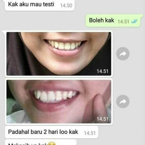 Orecare-tiens-pemutih-gigi-perontok-karang-gigi-tianshi