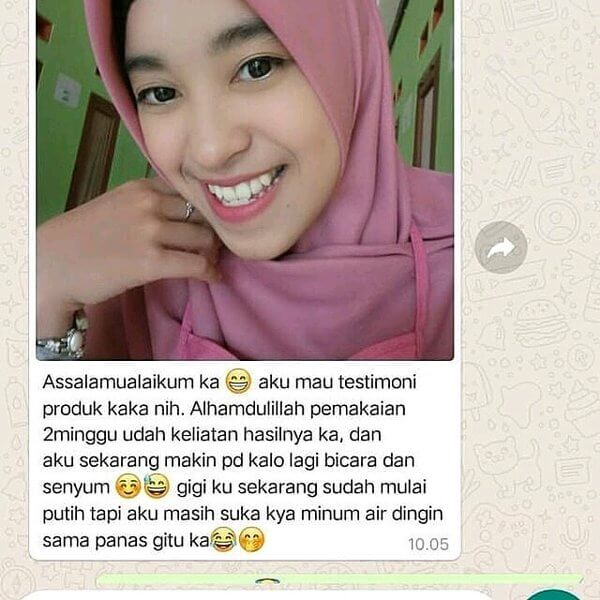 Orecare-tiens-pemutih-gigi-perontok-karang-gigi-tianshi