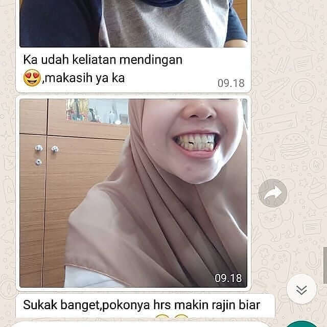 Orecare-tiens-pemutih-gigi-perontok-karang-gigi-tianshi