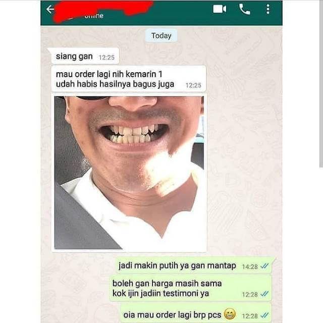 Orecare-tiens-pemutih-gigi-perontok-karang-gigi-tianshi