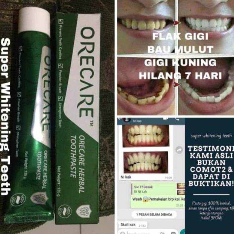 Orecare-tiens-pemutih-gigi-perontok-karang-gigi-tianshi