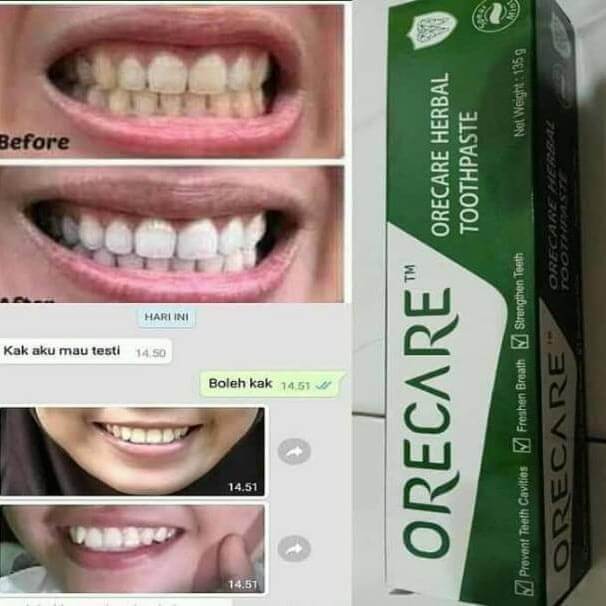 Orecare-tiens-pemutih-gigi-perontok-karang-gigi-tianshi
